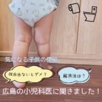 気になる子供の便秘。何日出ないとダメ？解消法、治療法は？広島の小児科医に聞きました！