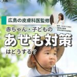 【広島の皮膚科医監修】赤ちゃん・子どものあせも対策はどうする？